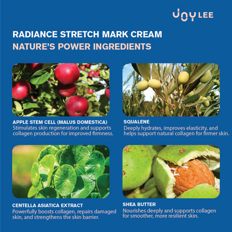 Joylee Radiance Stretch Mark Cream 160ml