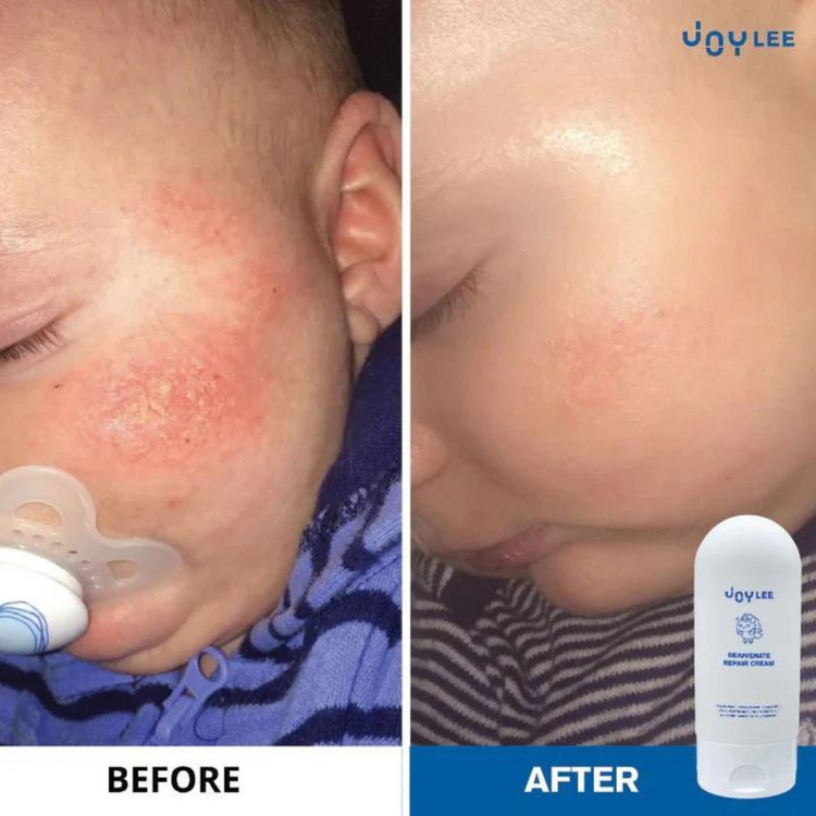 Joylee Rejuvenate Repair Cream