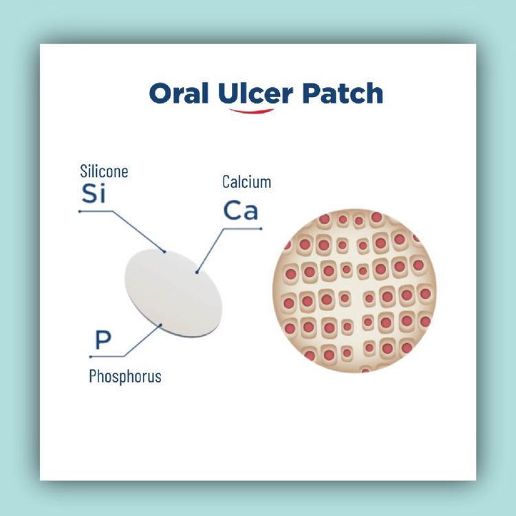 AcuMedi Oral Ulcer Patch 6'S