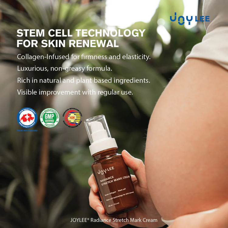 Joylee Radiance Stretch Mark Cream 160ml