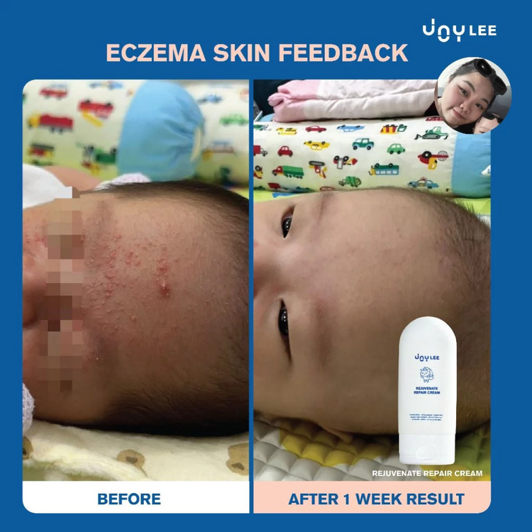 Joylee Rejuvenate Repair Cream