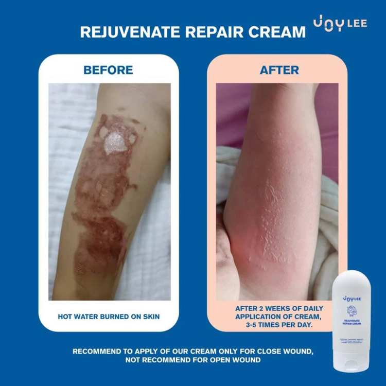Joylee Rejuvenate Repair Cream