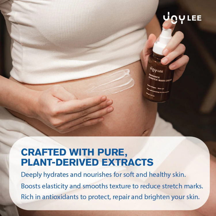Joylee Radiance Stretch Mark Cream 160ml