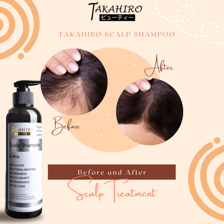 Takahiro Scalp Shampoo 300ml - Oily Hair-Hair Fall-Scalp Irritation-Sensitive Scalp