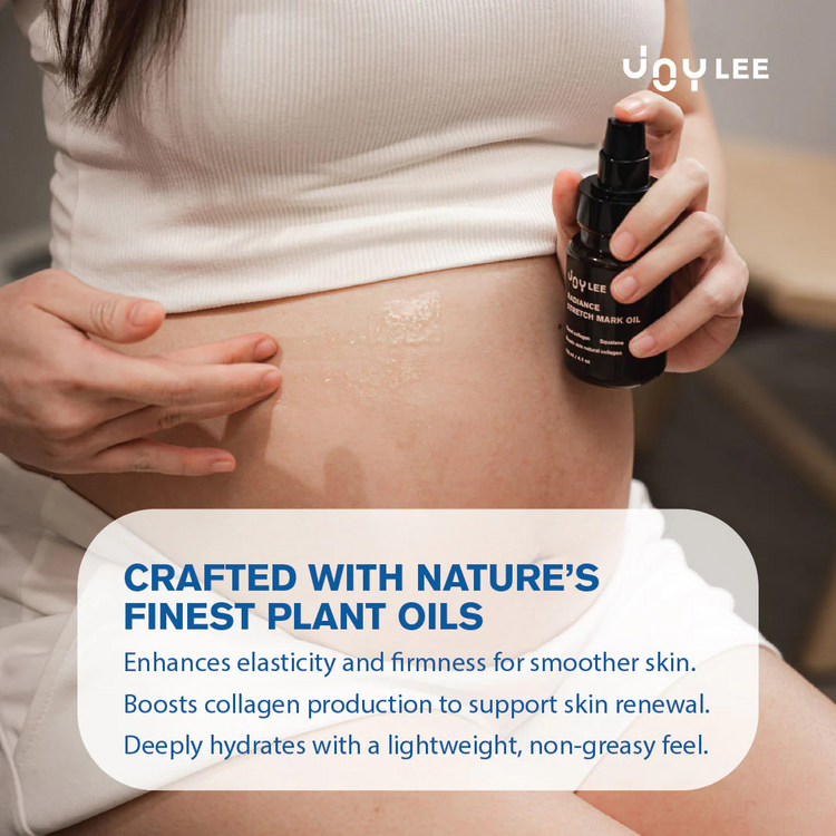 Joylee Radiance Stretch Mark Oil 100ml