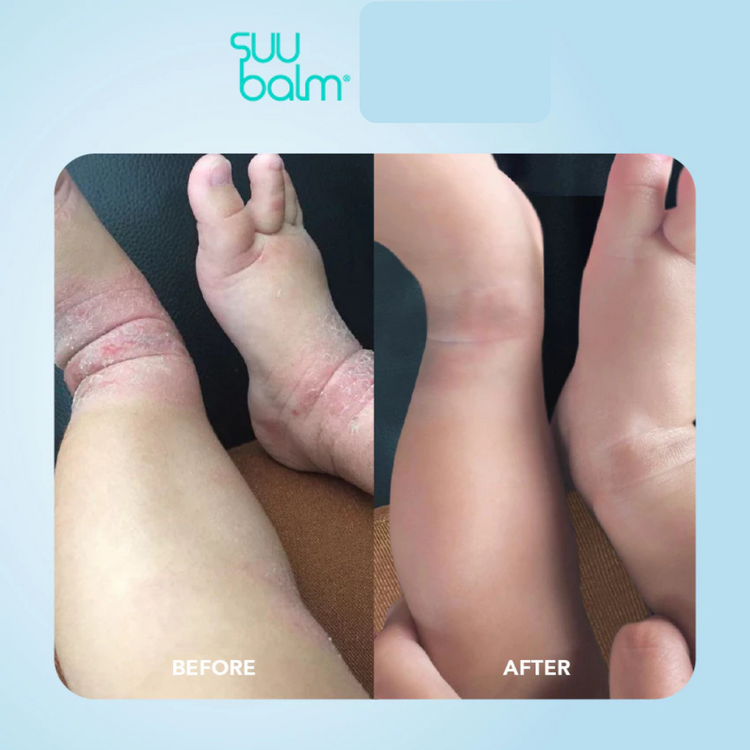 Suu Balm Kids Ceramide Moisturiser (75ml/200ml)