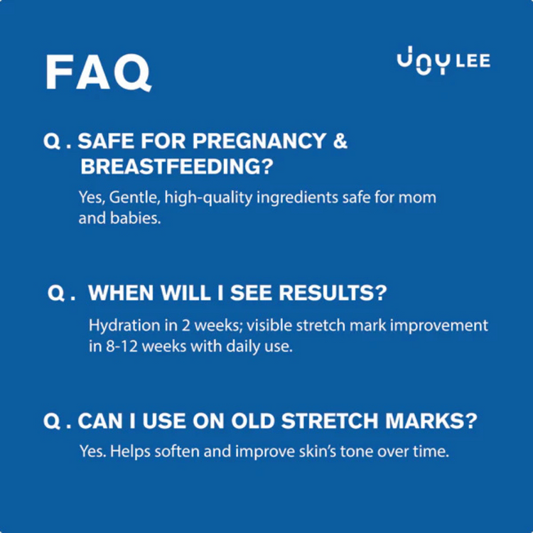 Joylee Radiance Stretch Mark Oil 100ml